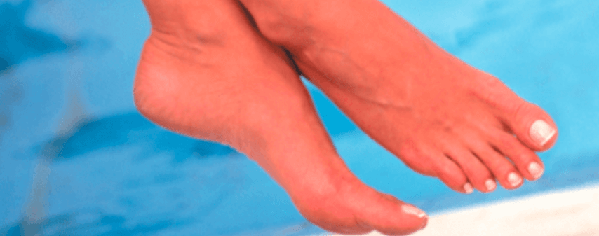 photo of reconstructed toenails